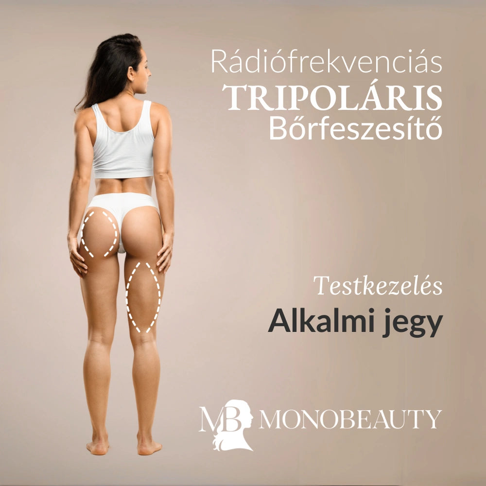 Tripoláris RF bőrfeszesítés egyszeri kezelés